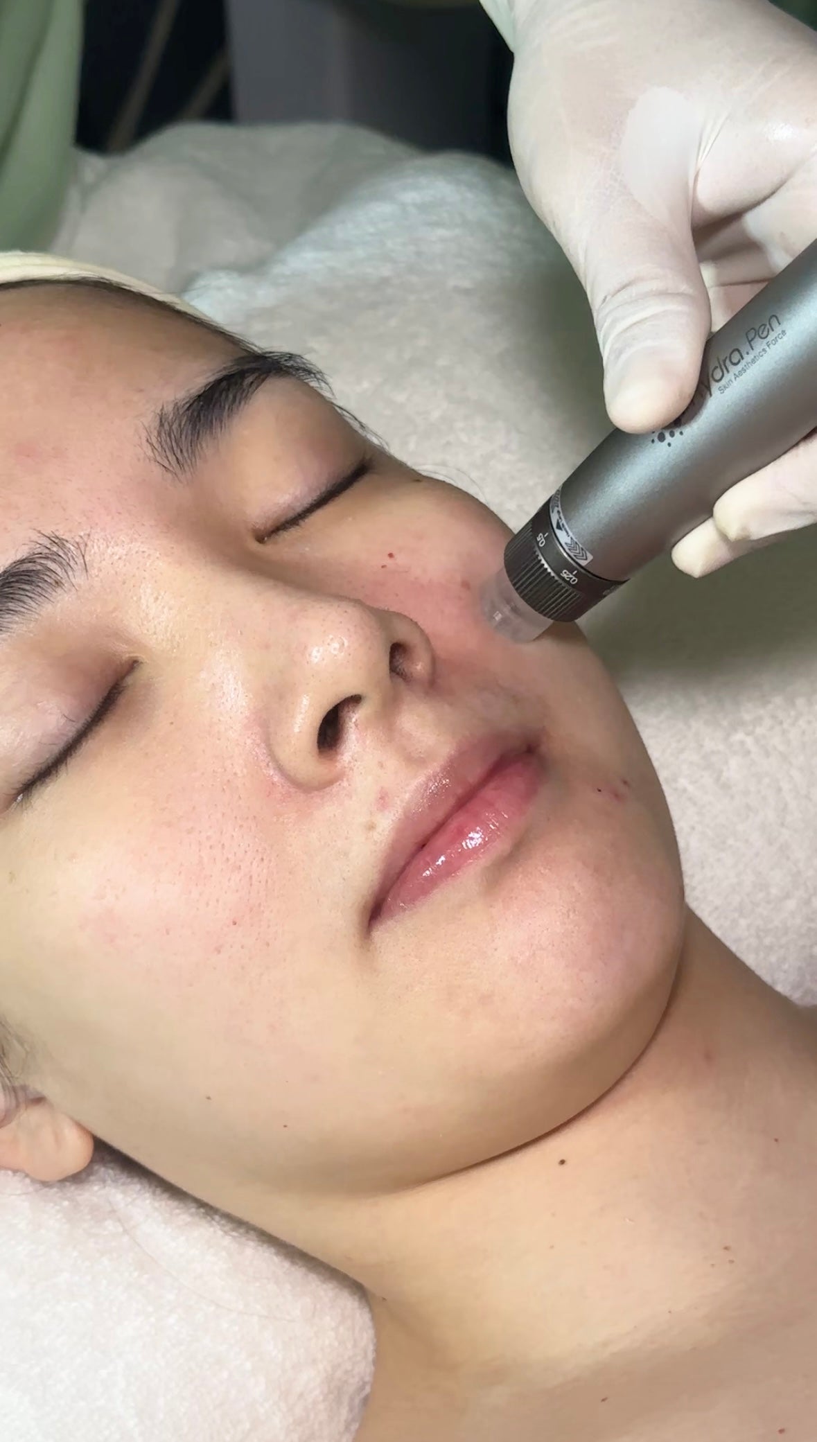 Exosome Facial